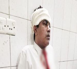 সিলেটে চলন্ত ট্রেনে দুর্বৃত্তের পাথর নিক্ষেপ, পরিচালক আহত