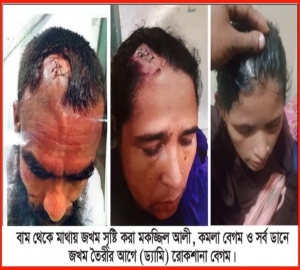 প্রতিপক্ষকে মিথ্যা মামলা দিয়ে গায়েল করতে কৃত্রিম যখম সৃষ্টিকারী কমলগঞ্জ হাসপাতালের স্বাস্থ্য সহকারী গ্রেফতার