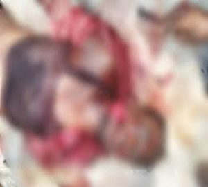 ট্রলির চাপায় আজমিরীগঞ্জে শ্রমিকের মৃত্যু