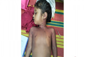 মাধবপুরে সাপের কামড়ে শিশুর মৃত্যু 