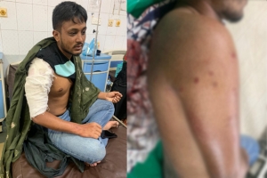 মৌলভীবাজারে বিরোধের জেরে ছাত্রলীগ কর্মী সুয়েব এর উপর হামলা