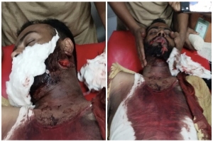 প্রতিপক্ষের হামলায় গুরুতর আহত পল্লী চিকিৎসক, থানায় মামলা দায়ের 